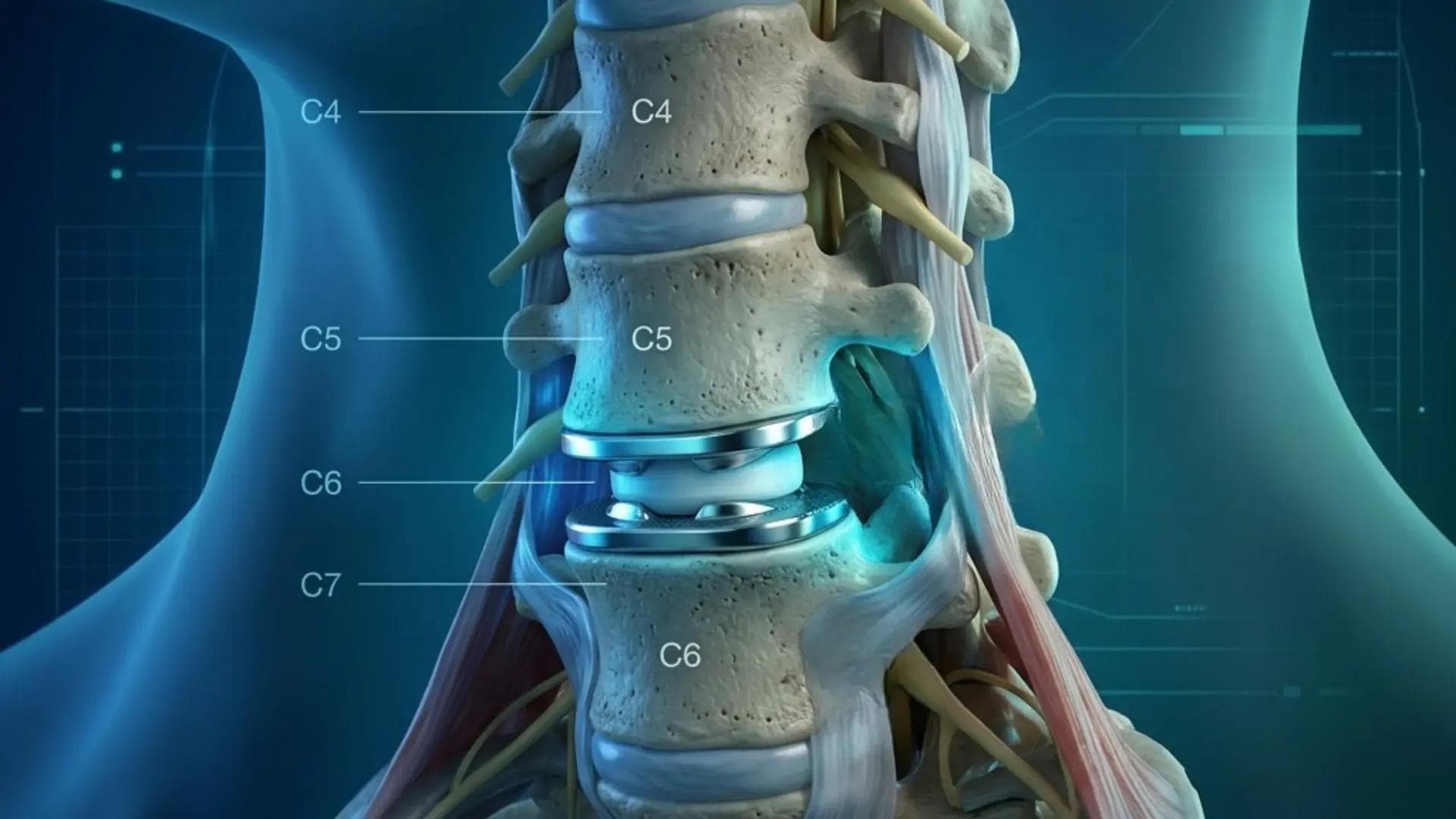 Arthrodesis Parallax Background